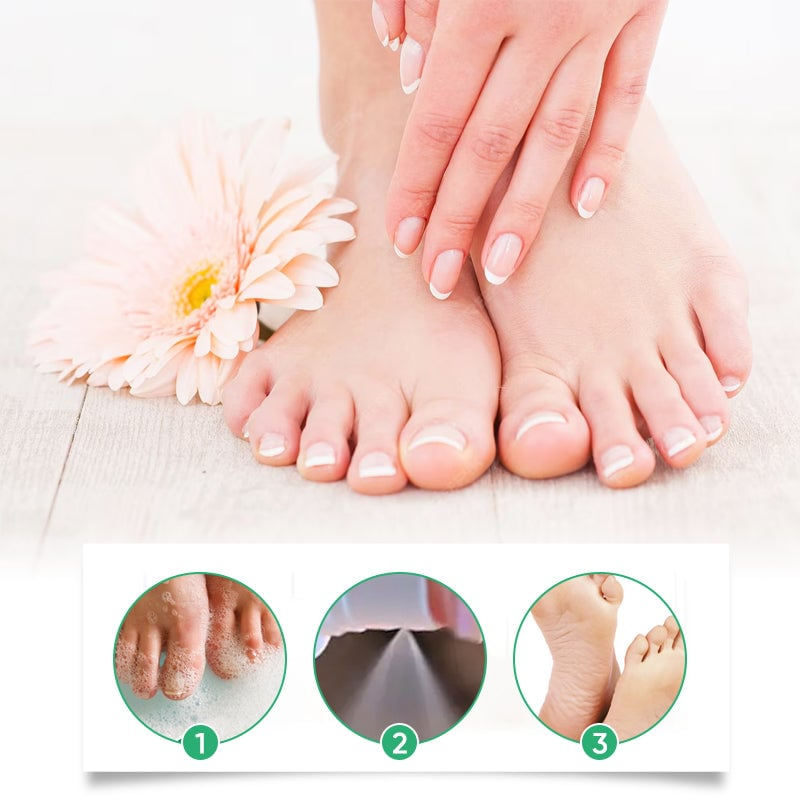 FootCare 1+1 ILMAINEN: Antimikrobinen Syvä Nesteytys Jalkahoito Suihke