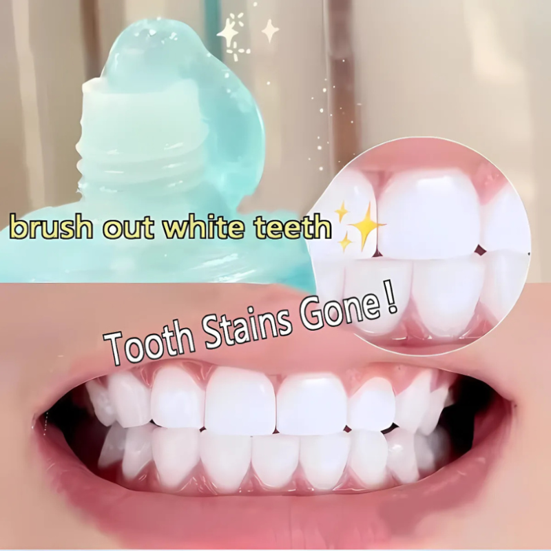 WhiteningToothpaste 1+1 ILMAINEN: Niacinamide-Valkaiseva Ja Tahroja Poistava Hammastahna