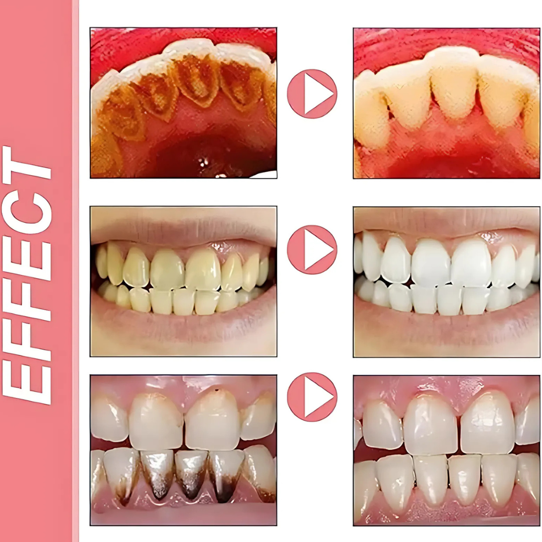 ProbioticToothpaste 1+1 ILMAISEKSI: Hellävarainen Valkaiseva Vahvistava Probioottinen Hammastahna