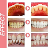 ProbioticToothpaste 1+1 ILMAISEKSI: Hellävarainen Valkaiseva Vahvistava Probioottinen Hammastahna