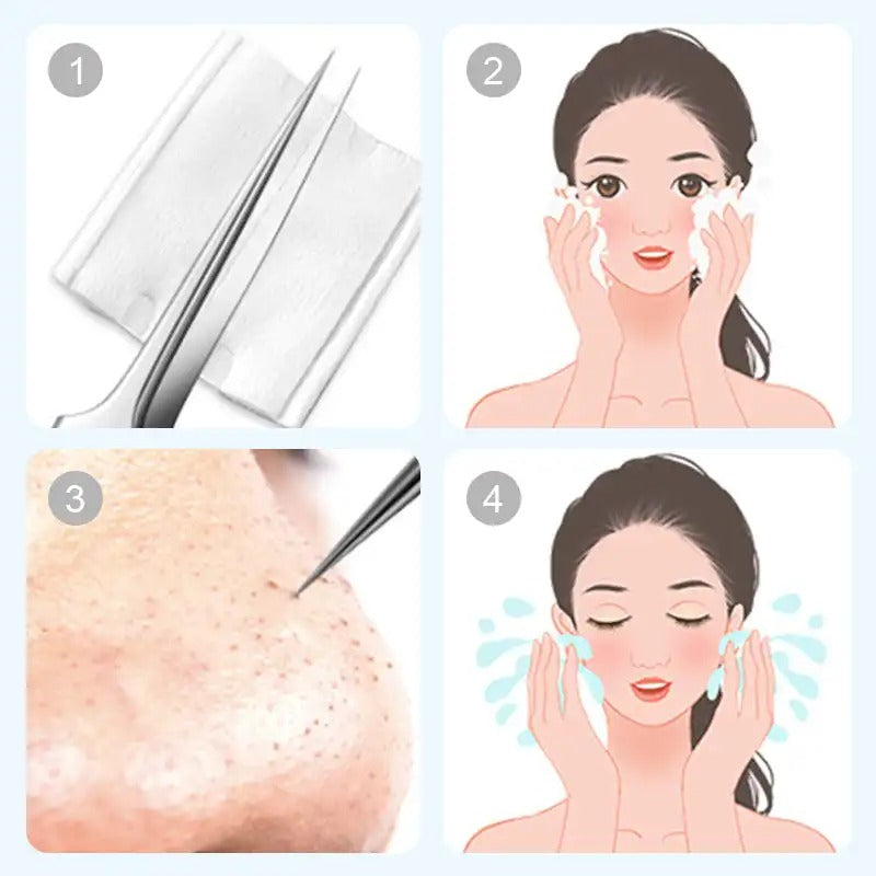 FacialTools - Ruostumattomasta Teräksestä Valmistettu Mustapäiden Poistotyökalusarja