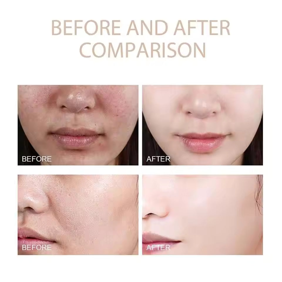 ExfoliatingSerum 1+1 ILMAISEKSI: Helppokäyttöinen Pehmeä Kuorinta-Ampulli Herkälle Iholle