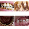 DentalCare – Helppo 360° Hammashoitovälinepakkaus Kotiin